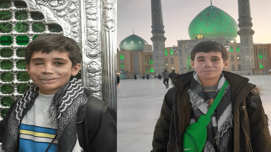 سرباز کوچکی که چشم و صورتش را داد، اما تسلیم نشد