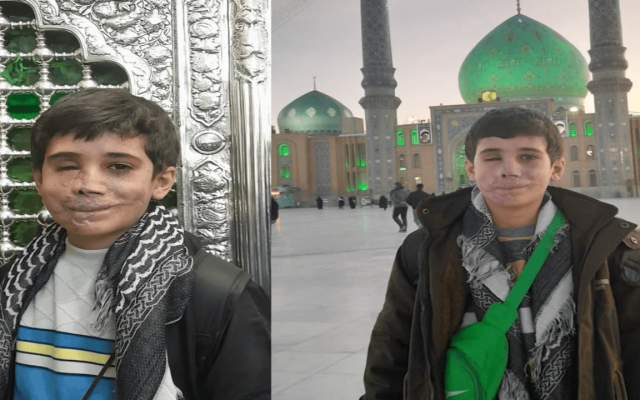 سرباز کوچکی که چشم و صورتش را داد، اما تسلیم نشد