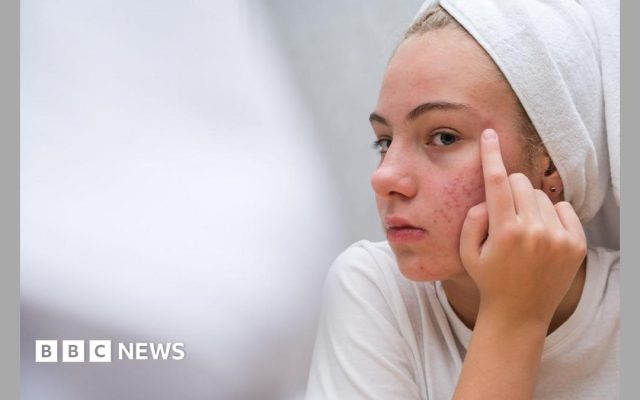 The simple skincare routine for teens that actually works - and five expert tips
