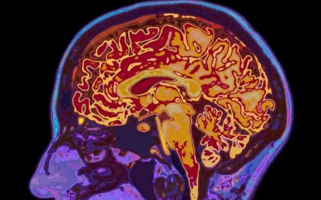 فلسفه ذهن چیست و چه کاربردی دارد؟