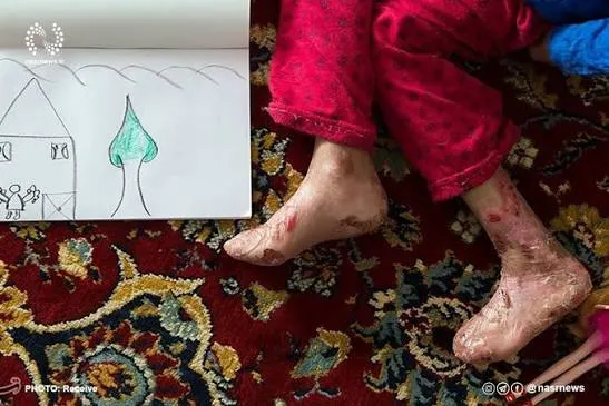 تخمین وجود 3میلیون بیمار نادر/لزوم آموزش پزشکان درباره بیماری‌های نادر