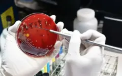 علوم پزشکی کرمانشاه: تکذیب مرگ دانشجوی دندانپزشکی بر اثر طاعون