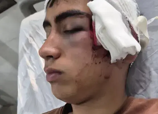ورود دادستانی بم به پرونده تنبیه بدنی دانشآموز در دهبکری