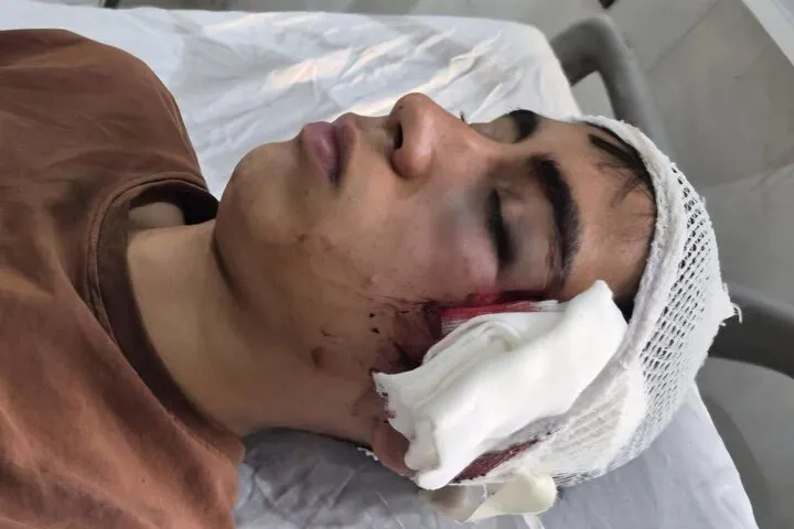 حادثه مصدومیت شدید دانشآموز دهبکری بم خبر ساز شد