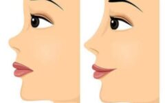 جراح بینی عروسکی در شیراز، معرفی لیست منتخب + ویژگی‌ها و نمونه کارها