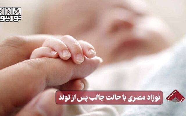 نورنما |نوزاد مصری با حالت جالب پس از تولد