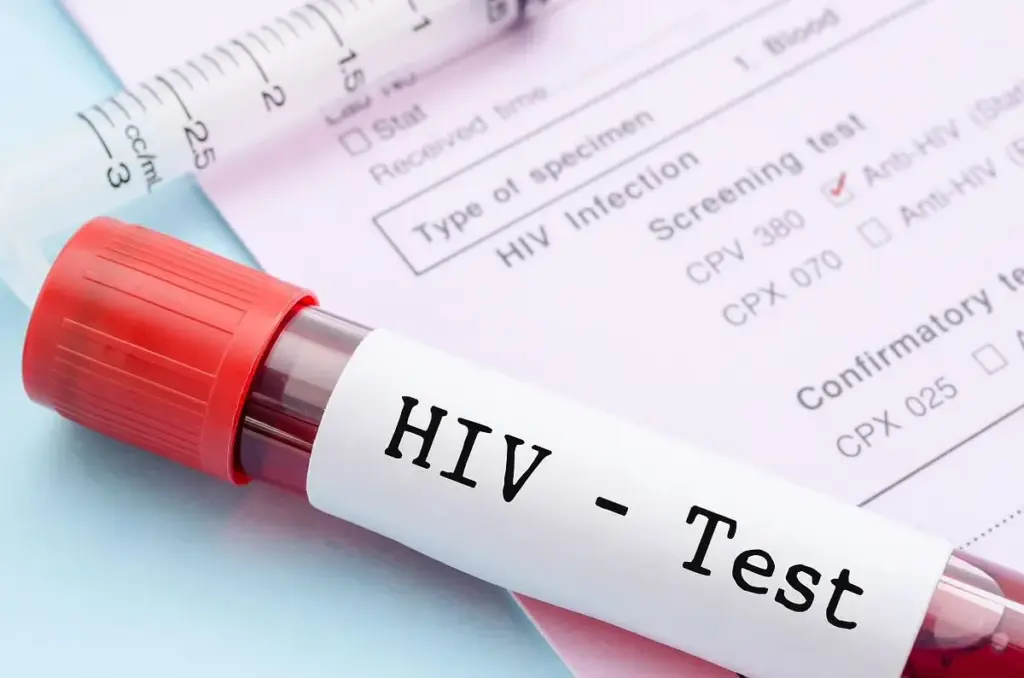 ترکیب دارویی جدید میتواند ویروس HIV را در بیمارانی که به درمان مقاوم شدهاند، کنترل کند