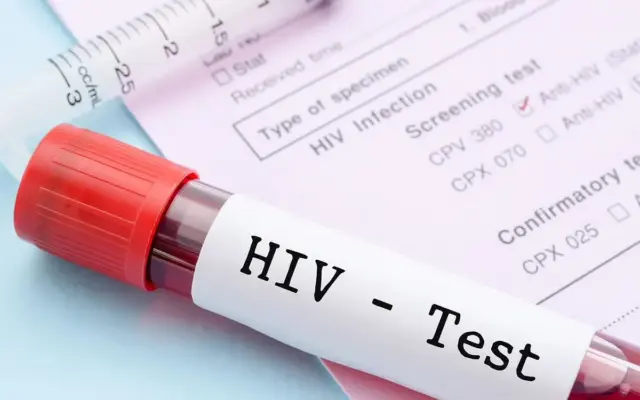 ترکیب دارویی جدید میتواند ویروس HIV را در بیمارانی که به درمان مقاوم شدهاند، کنترل کند