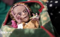 Newborn twins fight for survival as conflict fuels Yemen's hunger crisis