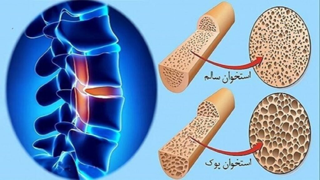 لبنیات بالاترین میزان جذب کلسیم در بدن/ ساخت ۶۰ درصد از بافت استخوان در کودکی
