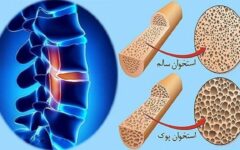 لبنیات بالاترین میزان جذب کلسیم در بدن/ ساخت ۶۰ درصد از بافت استخوان در کودکی
