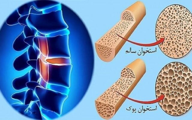 لبنیات بالاترین میزان جذب کلسیم در بدن/ ساخت ۶۰ درصد از بافت استخوان در کودکی