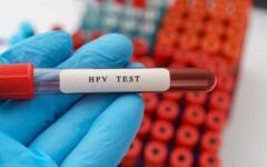 سن اچ‌پی‌وی به ۱۵ سال رسید | زنده ماندن ویروس زیر ناخن تا ۱۴ روز | اگر آزمایش HPV مثبت شد چه کنیم؟