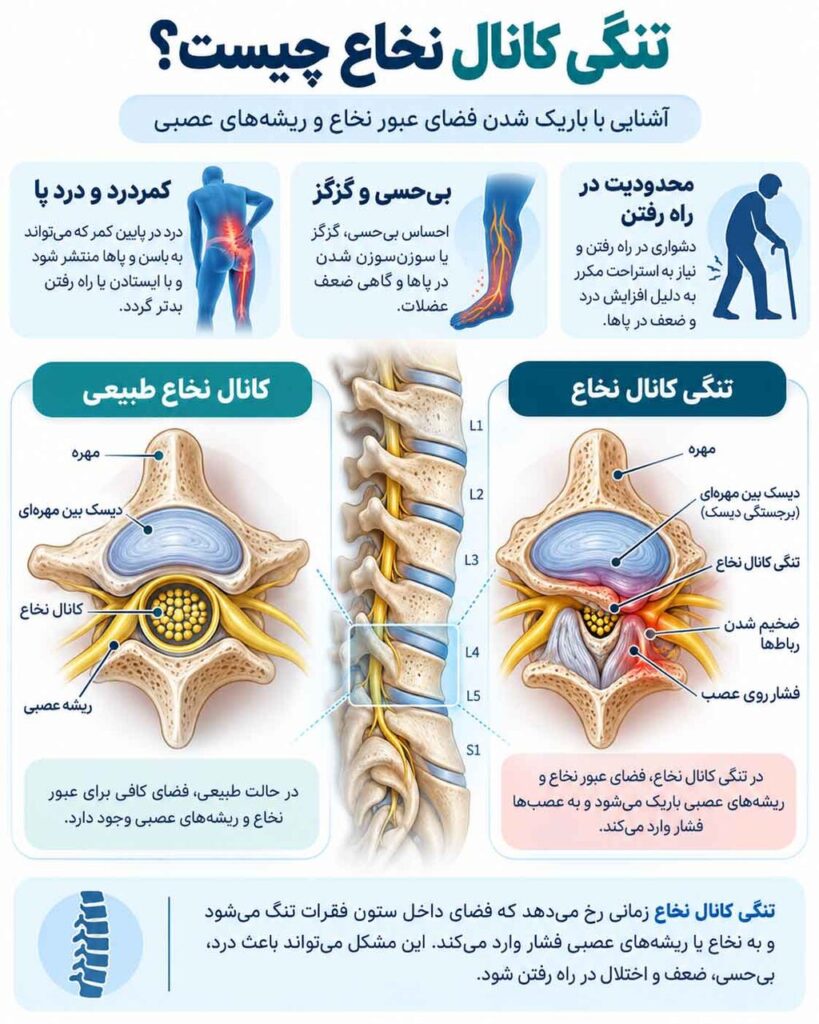 علائم تومور مغزی چیست؟ نشانههایی که نباید نادیده گرفته شوند