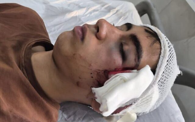 دانشآموز بمی قربانی خشونت معلم شد/ وعده احقاق حق از سوی آموزشوپرورش