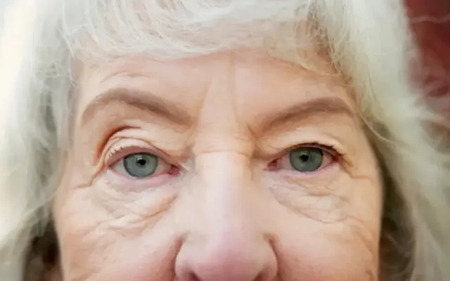 تغییر شکل قرنیه با جریان برق؛ روش آزمایشی جدید اصلاح نزدیکبینی بدون لیزیک