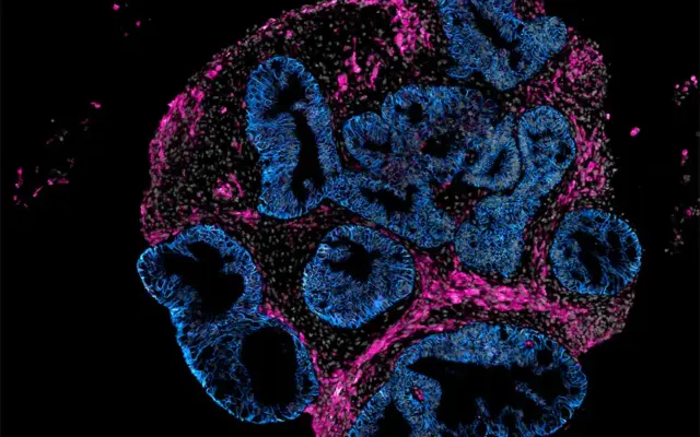 Intero Biosystems wants drugmakers to test on mini human intestines, not animals