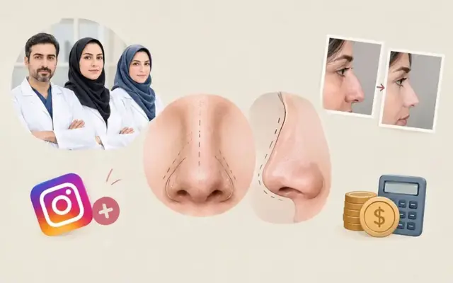 جراح بینی فانتزی شیراز: معرفی لیست منتخب به همراه نمونه کار و قیمت