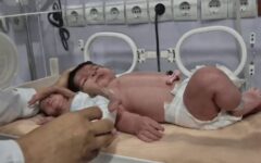 تولد نوزادی با وزن غیرمعمول ۵ کیلو و ۷۰۰ گرم در بندرعباس