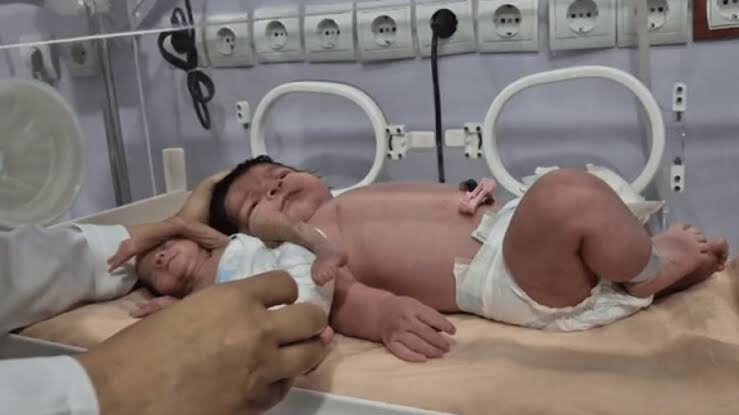 تولد نوزادی با وزن غیرمعمول ۵ کیلو و ۷۰۰ گرم در بندرعباس