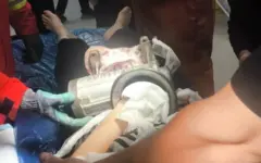رهاسازی دست کارگر زن از چرخ‌گوشت صنعتی پس از انتقال به بیمارستان