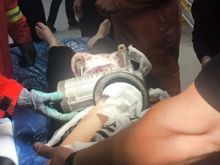 حادثه تلخ برای کارگر زن در تهران؛ دستش تا مچ در چرخ‌گوشت گیر کرد+ عکس